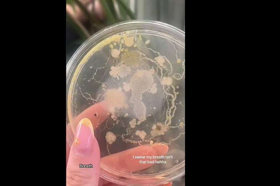 فيديو | تيك توكر تكشف عن أكثر الأماكن التي تحتوي على البكتيريا في الجسم .. فما هي؟