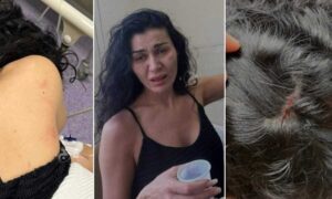 إصابات بالغة... القصة الكاملة لضرب الفنانة نادين الراسي